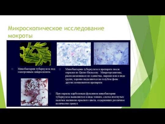 Микроскопическое исследование мокроты