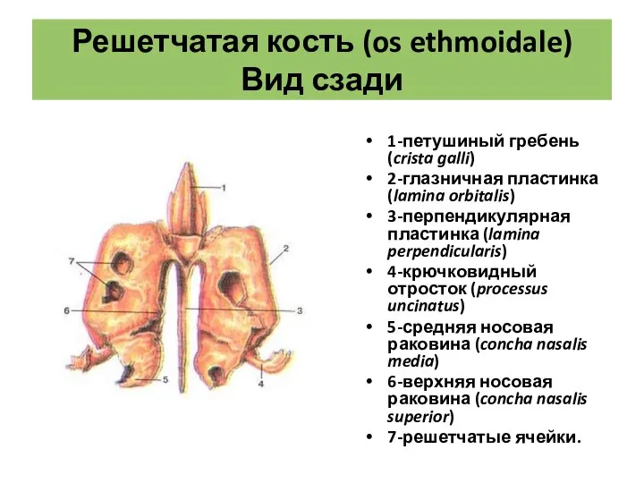 Решетчатая кость (os ethmoidale) Вид сзади 1-петушиный гребень (crista galli) 2-глазничная пластинка