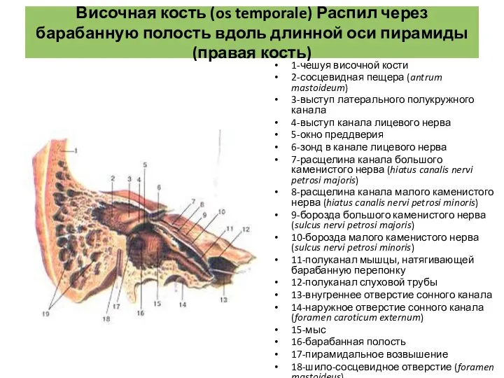 Височная кость (os temporale) Распил через барабанную полость вдоль длинной оси пирамиды