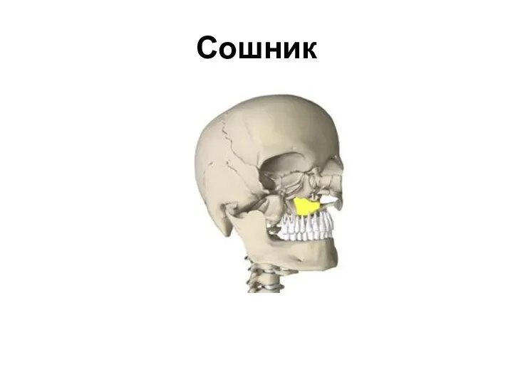 Сошник