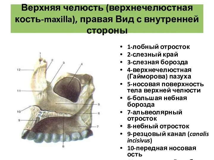 Верхняя челюсть (верхнечелюстная кость-maxilla), правая Вид с внутренней стороны 1-лобный отросток 2-слезный