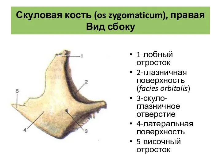 Скуловая кость (os zygomaticum), правая Вид сбоку 1-лобный отросток 2-глазничная поверхность (facies