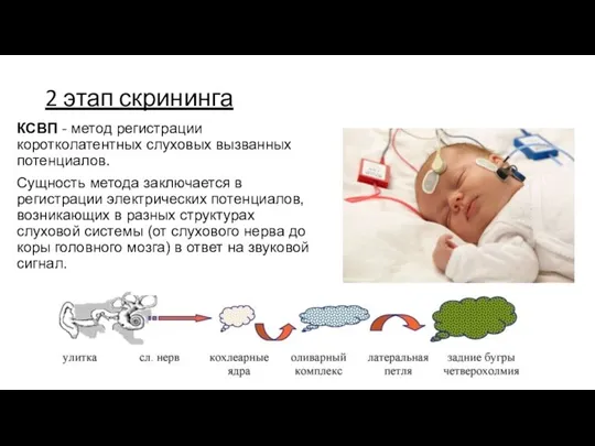 2 этап скрининга КСВП - метод регистрации коротколатентных слуховых вызванных потенциалов. Сущность