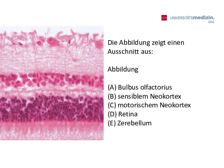 Die Abbildung zeigt einen Ausschnitt aus: Abbildung (A) Bulbus olfactorius (B) sensiblem