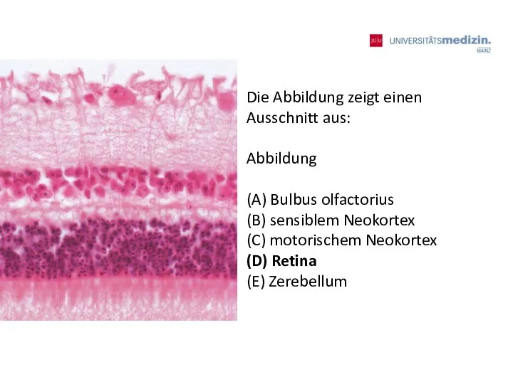 Die Abbildung zeigt einen Ausschnitt aus: Abbildung (A) Bulbus olfactorius (B) sensiblem