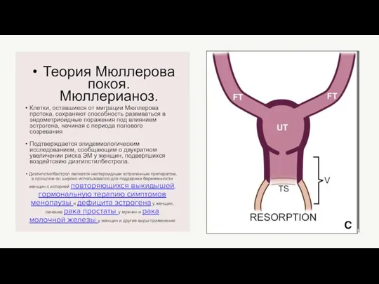 Теория Мюллерова покоя. Мюллерианоз. Клетки, оставшиеся от миграции Мюллерова протока, сохраняют способность