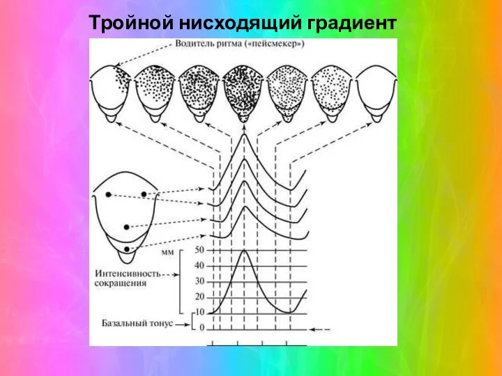 Тройной нисходящий градиент