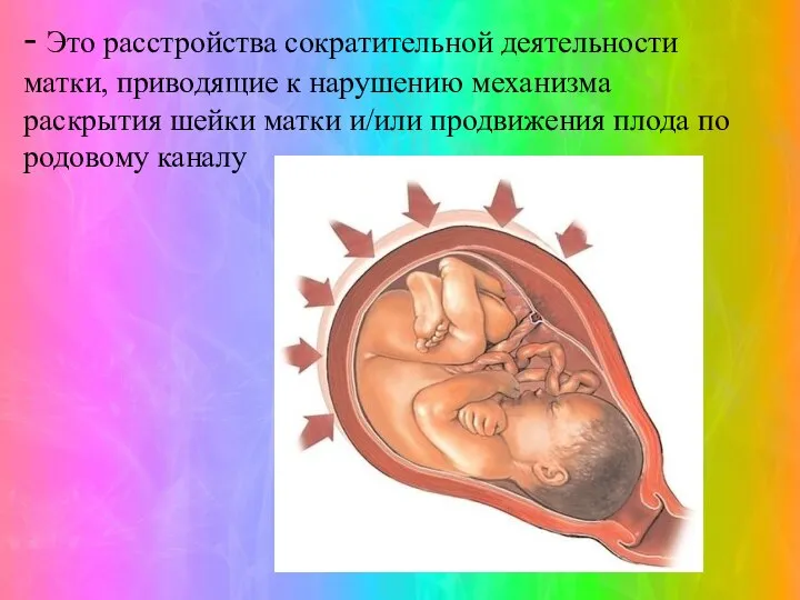 - Это расстройства сократительной деятельности матки, приводящие к нарушению механизма раскрытия шейки