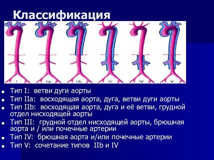 Классификация Тип I: ветви дуги аорты Тип IIa: восходящая аорта, дуга, ветви