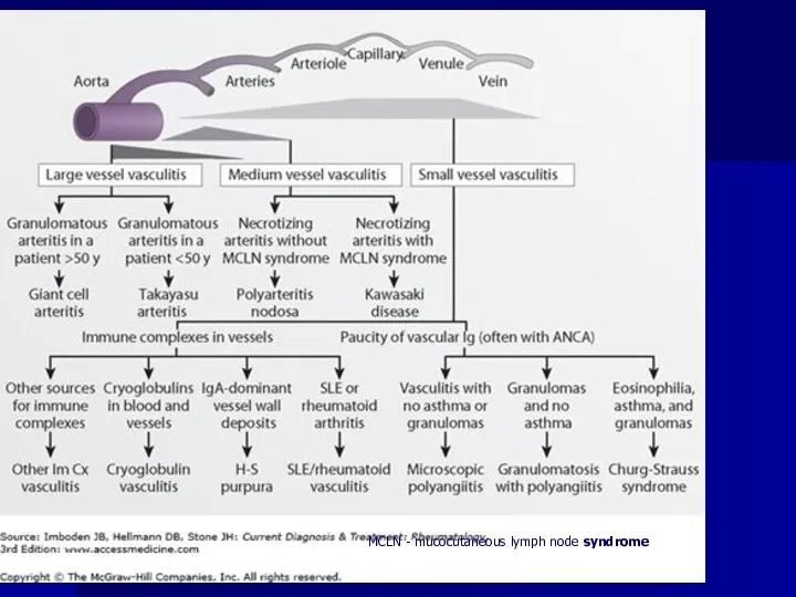 MCLN - mucocutaneous lymph node syndrome