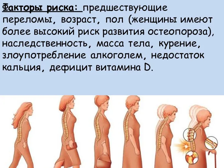 Факторы риска: предшествующие переломы, возраст, пол (женщины имеют более высокий риск развития