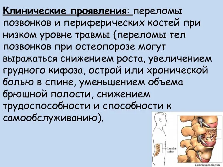 Клинические проявления: переломы позвонков и периферических костей при низком уровне травмы (переломы