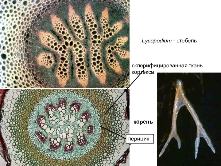 Lycopodium - стебель корень склерифицированная ткань кортекса перицикл