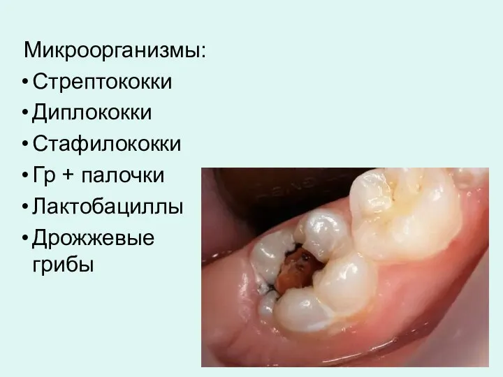 Микроорганизмы: Стрептококки Диплококки Стафилококки Гр + палочки Лактобациллы Дрожжевые грибы