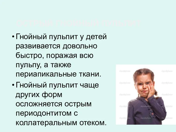 ОСТРЫЙ ГНОЙНЫЙ ПУЛЬПИТ Гнойный пульпит у детей развивается довольно быстро, поражая всю