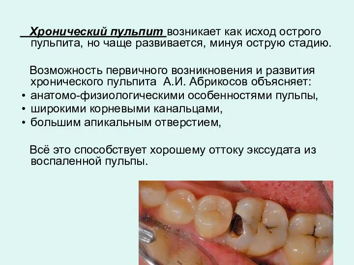 Хронический пульпит возникает как исход острого пульпита, но чаще развивается, минуя острую