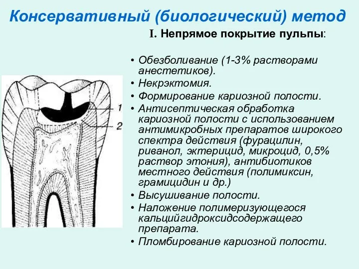 Консервативный (биологический) метод Непрямое покрытие пульпы: Обезболивание (1-3% растворами анестетиков). Некрэктомия. Формирование