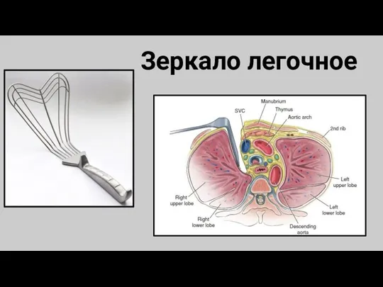 Зеркало легочное