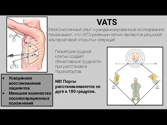 VATS Многочисленный опыт и рандомизированные исследования показывают, что VATS-резекции легких являются разумной