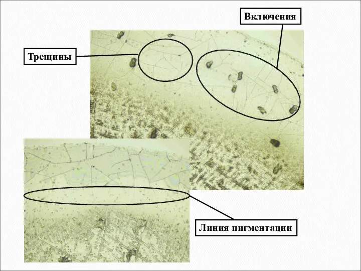 Включения Трещины Линия пигментации