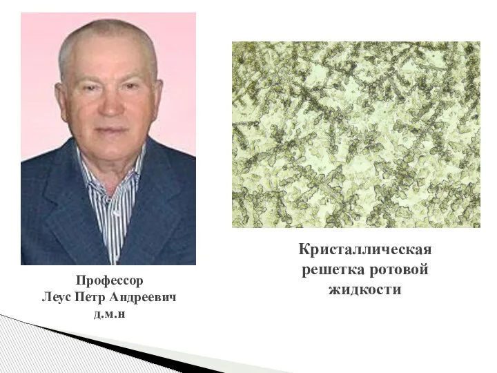 Профессор Леус Петр Андреевич д.м.н Кристаллическая решетка ротовой жидкости