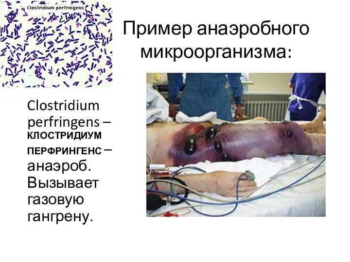 Пример анаэробного микроорганизма: Clostridium perfringens – КЛОСТРИДИУМ ПЕРФРИНГЕНС – анаэроб. Вызывает газовую гангрену.