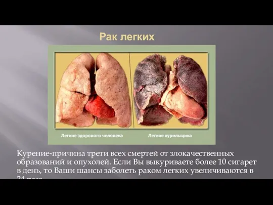 Рак легких Курение-причина трети всех смертей от злокачественных образований и опухолей. Если