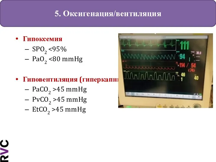 5. Оксигенация/вентиляция Гипоксемия SPO2 PaO2 Гиповентиляция (гиперкапния) PaCO2 >45 mmHg PvCO2 >45 mmHg EtCO2 >45 mmHg