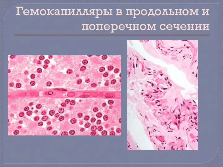 Гемокапилляры в продольном и поперечном сечении