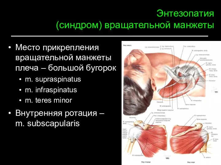 Энтезопатия (синдром) вращательной манжеты Место прикрепления вращательной манжеты плеча – большой бугорок