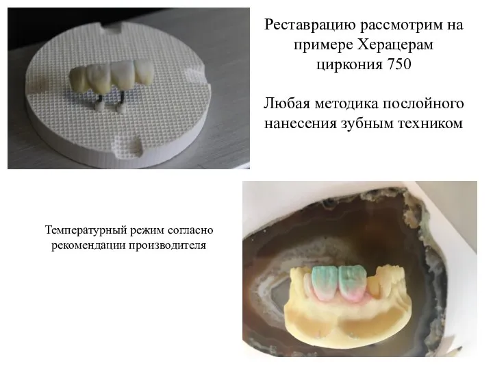 Реставрацию рассмотрим на примере Херацерам циркония 750 Любая методика послойного нанесения зубным