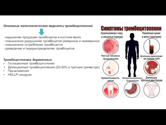 Основные патогенетические варианты тромбоцитопений -нарушение продукции тромбоцитов в костном мозге - повышенное