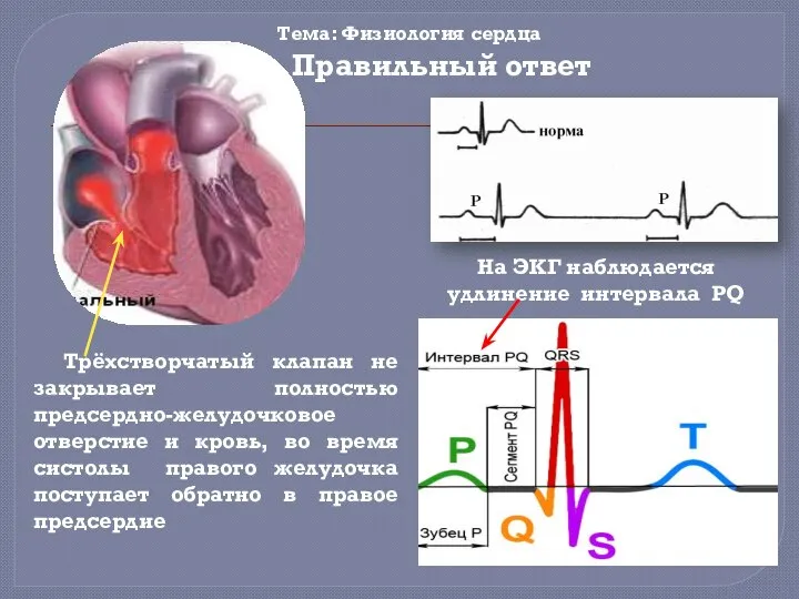 Тема: Физиология сердца Трёхстворчатый клапан не закрывает полностью предсердно-желудочковое отверстие и кровь,