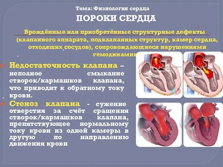 Врождённые или приобретённые структурные дефекты (клапанного аппарата, подклапанных структур, камер сердца, отходящих
