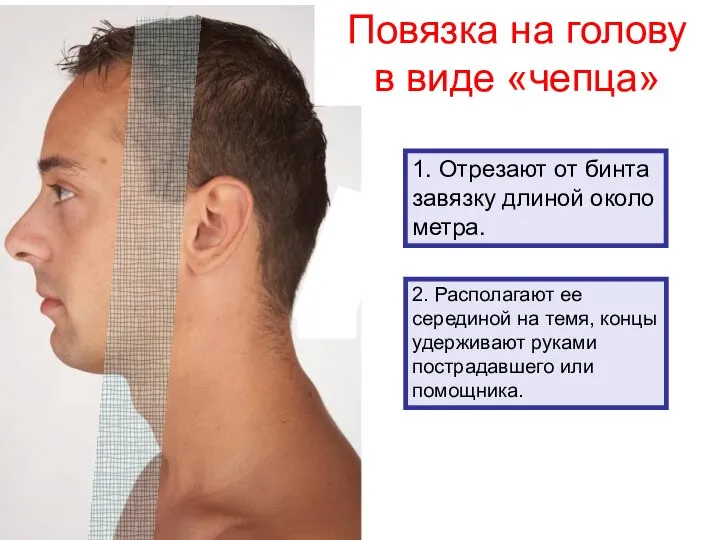 Повязка на голову в виде «чепца» 1. Отрезают от бинта завязку длиной