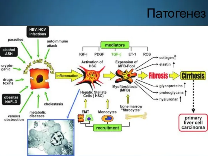 Патогенез