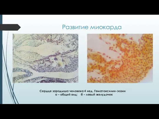 Развитие миокарда Сердце зародыша человека 4 нед. Гематоксилин-эозин а – общий вид; б – левый желудочек