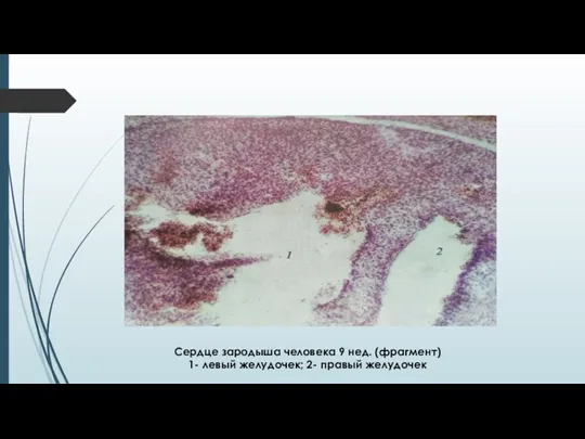 Сердце зародыша человека 9 нед. (фрагмент) 1- левый желудочек; 2- правый желудочек
