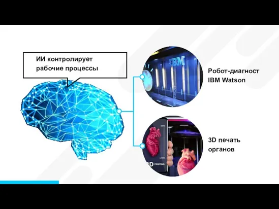 ИИ контролирует рабочие процессы Робот-диагност IBM Watson 3D печать органов