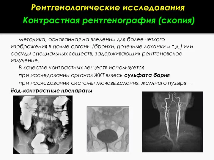 Контрастная рентгенография (скопия) методика, основанная на введении для более четкого изображения в