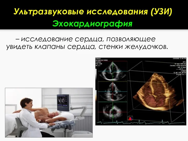 – исследование сердца, позволяющее увидеть клапаны сердца, стенки желудочков. Ультразвуковые исследования (УЗИ) Эхокардиография