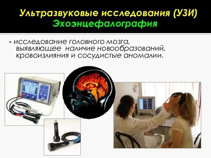 - исследование головного мозга, выявляющее наличие новообразований, кровоизлияния и сосудистые аномалии. Ультразвуковые исследования (УЗИ) Эхоэнцефалография