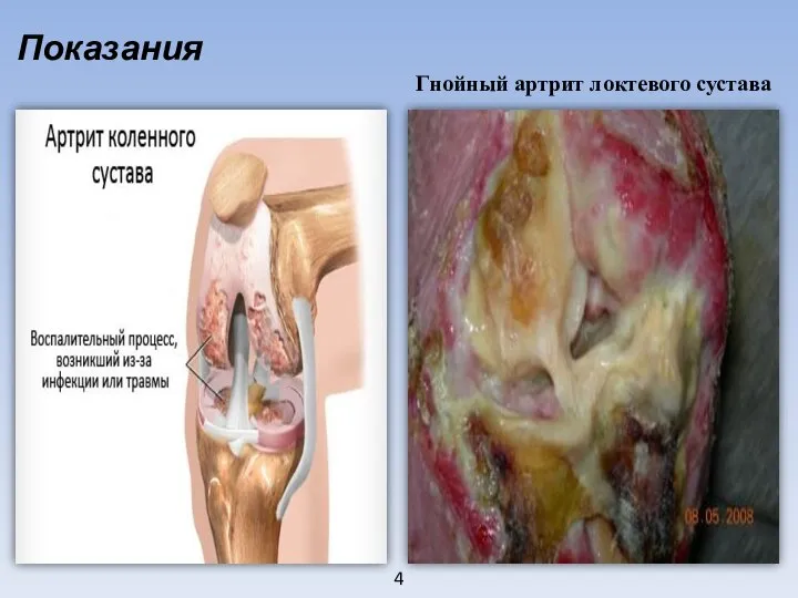 4 Показания