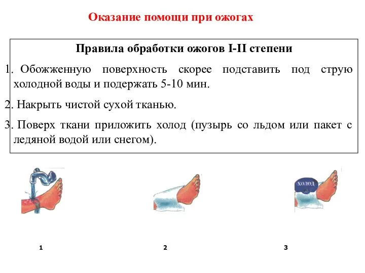 Оказание помощи при ожогах Правила обработки ожогов I-II степени Обожженную поверхность скорее