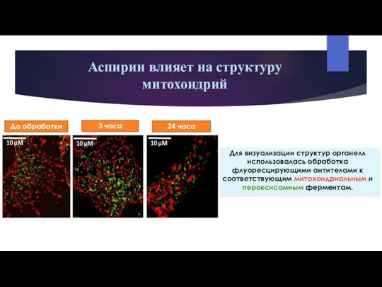 Аспирин влияет на структуру митохондрий До обработки 3 часа 24 часа Для