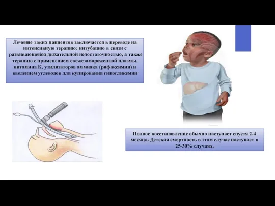 Лечение таких пациентов заключается в переводе на интенсивную терапию: интубацию в связи