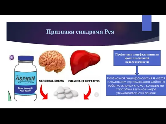 Признаки синдрома Рея Печёночная энцефалопатия на фоне печёночной недостаточности Печёночная энцефалопатия является