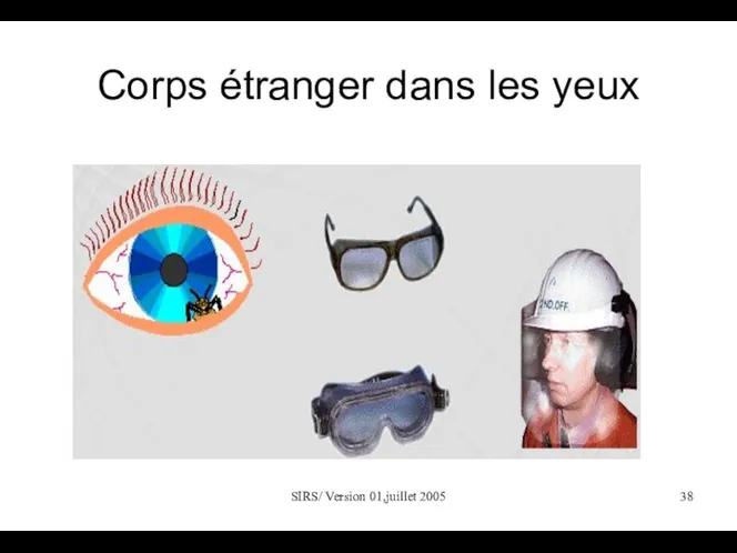 SIRS/ Version 01,juillet 2005 Corps étranger dans les yeux