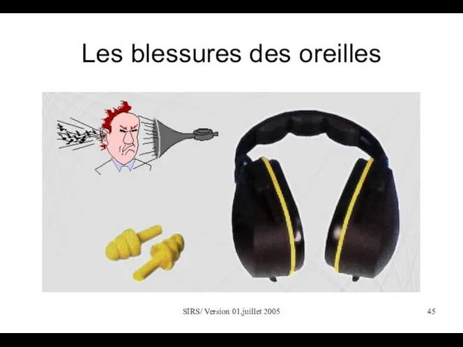 SIRS/ Version 01,juillet 2005 Les blessures des oreilles