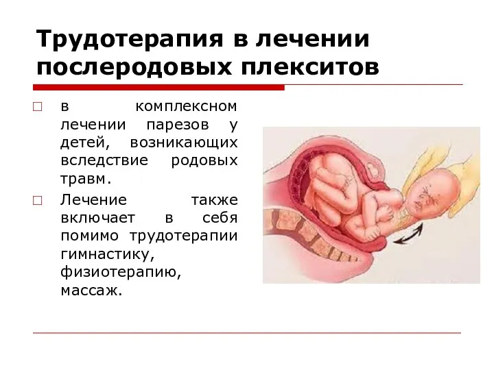 Трудотерапия в лечении послеродовых плекситов в комплексном лечении парезов у детей, возникающих